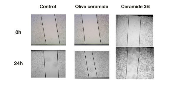 Strong Repair, Full Anti-Aging - Olive Ceramide Refreshes the Perception of Efficacy(图3)